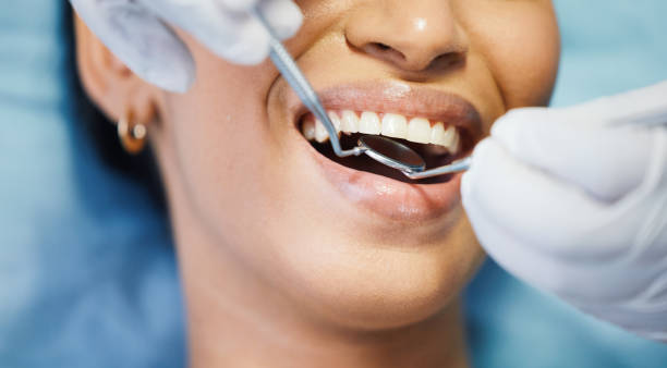 Best Emergency Dental Extractions in Quincy, MI