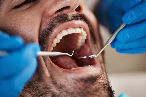 Best Emergency Dentist for Knocked-Out Tooth in Quincy, MI