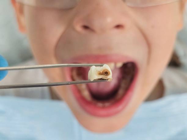 Best Pediatric Emergency Dentist in Quincy, MI