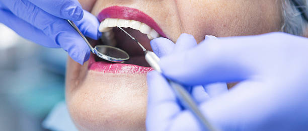 Best Broken or Cracked Tooth Emergency Dentist in Quincy, MI
